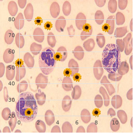 Homocystinuria due to defect in methylation (cbl g)