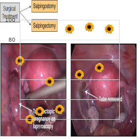 Hyperferritinemia, hereditary, with congenital cataracts