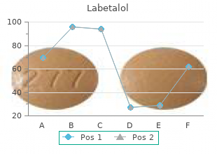buy generic labetalol online