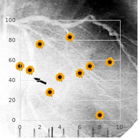 Spondylo camptodactyly syndrome