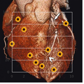 Craniosynostosis radial aplasia syndrome