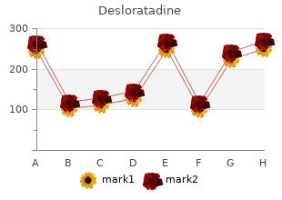 purchase desloratadine visa