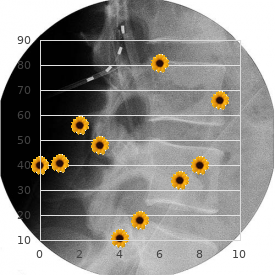 Chromosome 18 ring