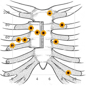 Spastic paraplegia type 3, dominant