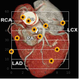 Hypertelorism hypospadias syndrome