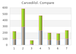 cheap 25mg carvedilol amex