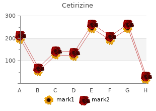 buy 5mg cetirizine otc