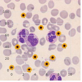 Otosclerosis, familial