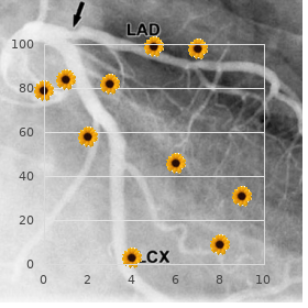 Acute respiratory distress syndrome