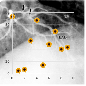 Ectodermal dysplasia anhidrotic