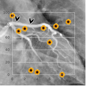 Alopecia macular degeneration growth retardation