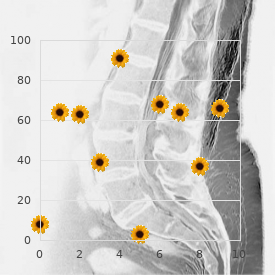 Velofacioskeletal syndrome