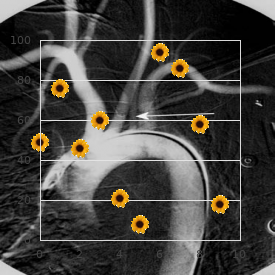 Hanhart syndrome