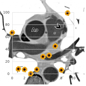 Cystic adenomatoid malformation of lung