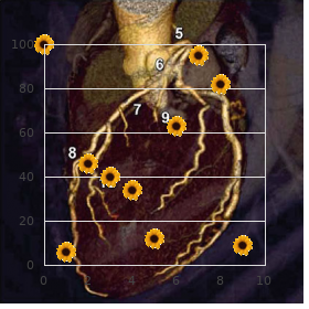 Congenital articular rigidity