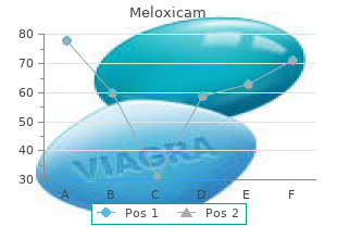 buy discount meloxicam 7.5 mg on-line