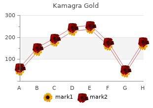 buy 100mg kamagra gold with mastercard