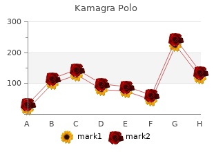 discount kamagra polo 100mg with mastercard