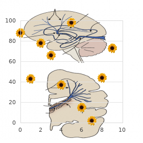 Nijmegen breakage syndrome