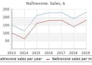 naltrexone 50 mg mastercard