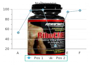 naltrexone 50mg low price