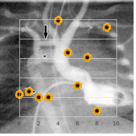 Dwarfism stiff joint ocular abnormalities