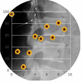 Congenital stenosis of cervical medullary canal