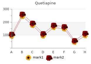 buy generic quetiapine 300mg line