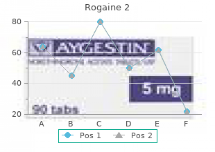 order rogaine 2 60  ml without prescription