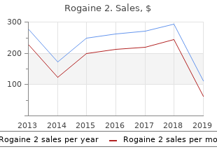order rogaine 2 60  ml free shipping