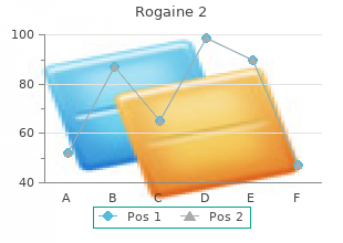 safe rogaine 2 60 ml