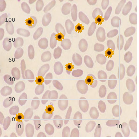 Mesenteric ischemia