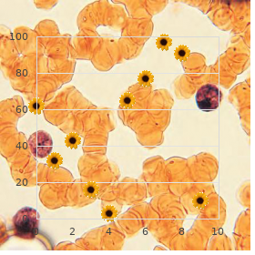 Neuroendocrine cancer