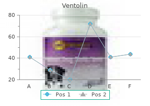 ventolin 100mcg cheap