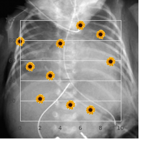 Micrencephaly corpus callosum agenesis