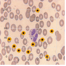 Niemann Pick C1 disease