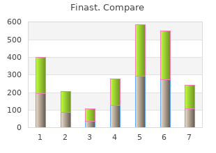 buy finast 5mg without a prescription