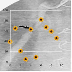 Multiple synostoses syndrome 1