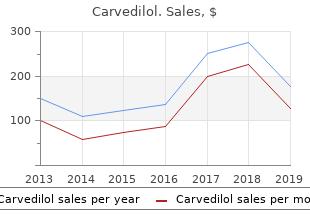 purchase carvedilol without prescription