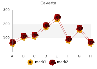 generic 50 mg caverta fast delivery