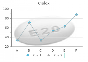 cheap 500mg ciplox fast delivery