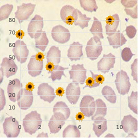 Mounier-Kuhn syndrome