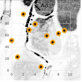 Oculo-auriculo-vertebral spectrum