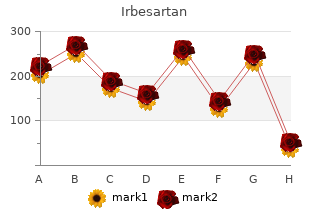 generic irbesartan 300mg line