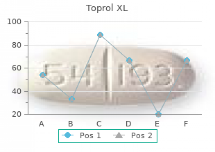 buy cheap toprol xl 100mg line