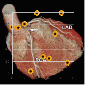 Sialidosis type 1 and 3