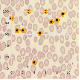 Coloboma of macula