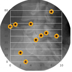 Dwarfism deafness retinitis pigmentosa