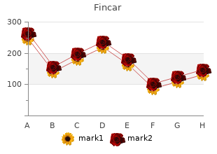 buy fincar uk