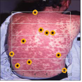 Myelodysplasia
